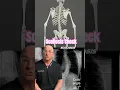 Download Lagu Here’s When Your Scoliosis Gets Worse ↩️↪️ #shorts