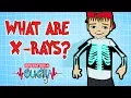 Download Lagu How do X-Rays Work? | Broken Bones | Operation Ouch