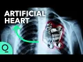Lagu Permanent Artificial Hearts Are Closer Than You Think