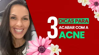 3 Dicas para acabar com a Acne