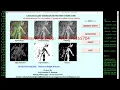 Cassava Leaf Disease Classification Using CNN Python Project With Source Code