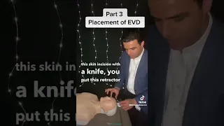 Placement of EVD