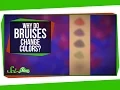Why Do Bruises Change Colors