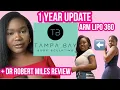 1 Year Post Op Arm Lipo 360 Dr Miles Tampa Bay Body Sculpting Review Autograph Arms