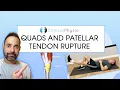 Quadriceps And Patella Tendon Rupture Expert Physio Review