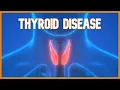 Thyroid Disease Hyperthyroidism vs Hypothyroidism