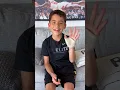 I BROKE MY FIRST BONE