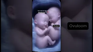 This Twin Ultrasound Will Make You Cry Happy Tears