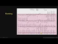 Technology - Stress Testing Pearls