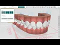 Quick Start Guide for Titan Dental Design