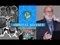 Orbital Masses Pattern Recognition by Dr Barton Branstetter