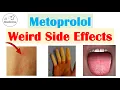 Metoprolol Beta Blockers Weird Side Effects Skin Gastrointestinal Psychological
