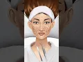 Giant Acne Black Head Pimple Removal - Acne Deep Cleaning