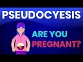 phantom pregnancy Pseudocyesis Couvade Syndrome