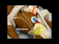Infant Respiratory Distress Signs