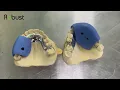 Acrylic processing for cast partial dentures