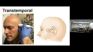 DOPPLER TRANSCRIANO