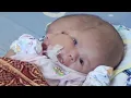 Download Lagu Orangtua Berdoa untuk Keajaiban Setelah Bayi Mereka Lahir dengan Dua Wajah