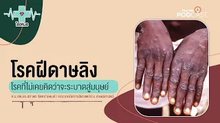 ควรทำอย่างไรหากโดนลิงกัดหรือข่วน