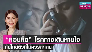 โรคหอบหืดแบ่งระดับความรุนแรงได้กี่ระดับ