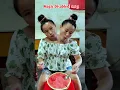 Lagu Tasbih song | conjoined twins sister omg | new tiktok video#godblessyou#shorts#viralshorts#newtiktok