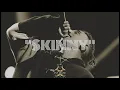 Dizzy X Omar - SKINNY (Remix)