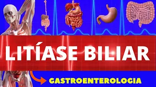 LITÍASE BILIAR (PEDRA NA VESÍCULA) - CAUSAS, SINTOMAS, DIAGNÓSTICO E TRATAMENTO - GASTROENTEROLOGIA