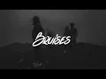 Lewis Capaldi - Bruises
