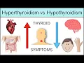 Hyperthyroidism vs Hypothyroidism Symptoms MADE EASY Thyroid Explained