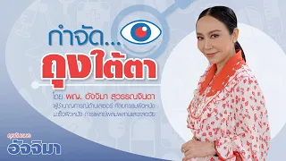 ถุงใต้ตาเกิดจากสาเหตุอะไรบ้าง