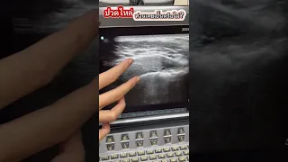  ทำไมถึงปวดไหล่ขวาเวลาเอามือยกขึ้นหรือบิดแขน 