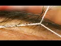 Eyebrow Threading at 30 000 FPS in Ultra Slow Motion Tweezing and Waxing too