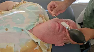 Cranial Facial Release CFR Testimonials Dr Manish Sojitra Chiropractor Princeton NJ