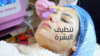 جلسة تنظيف البشرة مع د داليا داوود 