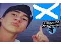 Calum Hood singing in a Scottish Accent - I m Gonna Be 500 Miles