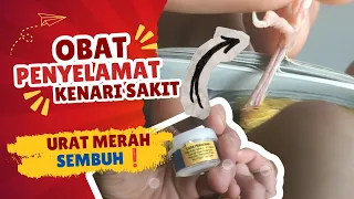 Jangan Dibiarkan! Penyebab & Obat Kaki Urat Merah Kenari