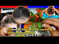 Download Lagu Tratamiento para quitar la CASPA psoriasis Dermatitis - Efectivo Remedio Natural casero - DuckEdwin