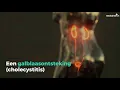 Download Lagu Een galblaasontsteking