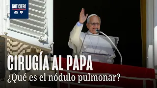 Papa León XIV será operado del pulmón: ¿Qué riesgos tiene la cirugía?