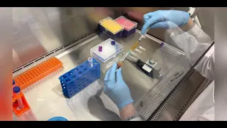 Plasma Extraction Workflow