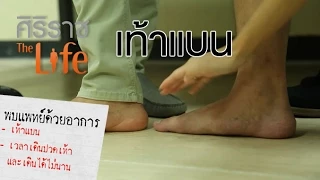 ทำไมคนที่มีเท้าแบนถึงปวดเท้าเร็วกว่าคนปกติ ทั้งที่เท้ามีความยืดหยุ่นมาก