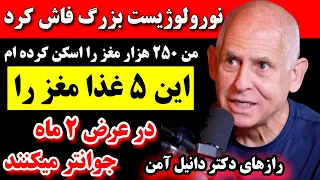 من ۲۵۰ هزار مغز را اسکن کرده ام  این ۵ غذا مغز را در عرض ۲ ماه جوان تر می کنند  دندنها