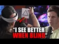 Woman Who Can See Without Her Eyes Leaves Danny SPEECHLESS Dalia Burgoin