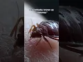 Download Lagu Fun Fact About Bed Bug Bites!