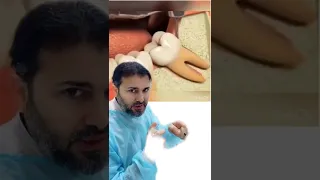 قلع ضرس العقل جراحي  كيف الطريقه دندنها