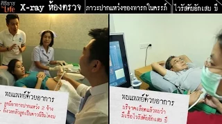 ไวรัสตับอักเสบบี ถ้าไม่มีอาการ จะเป็นอันตรายหรือไม่