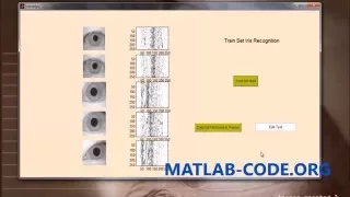 IRIS RECOGNITION USING MATLAB