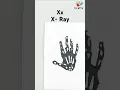 X for X-Ray Easy Alphabet handprint art