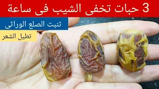 3 حبات معجزة❗ في ساعة واحدة يختفي الشيب نهائيا بدون صبغات تنبت الصلع  و تطويل الشعر فى اسبوع🛑