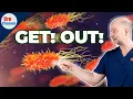 Bacteria won t leave your prostate Do this UroChannel